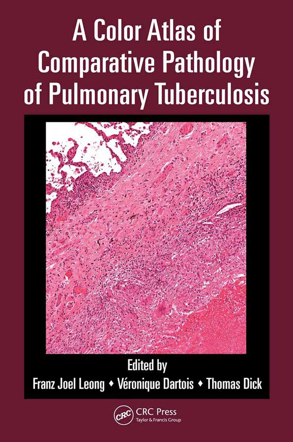 A Color Atlas of Comparative Pathology of Pulmonary Tuberculosis